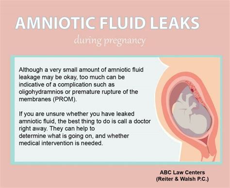 does leaking amniotic fluid smell|Signs of Leaking Amniotic Fluid vs. Discharge (& What to Do)